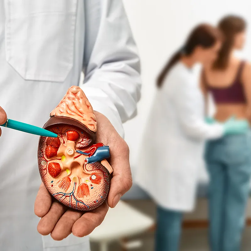 Kidney Stones